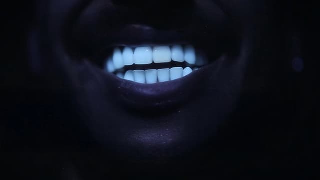 Des dents blanches... au rire jaune !